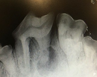 dental xray 3